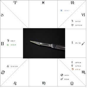 astrological question about surgery